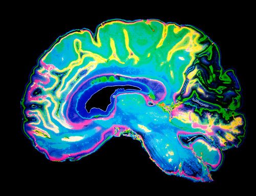 Coloured MRI Scan Of Human Brain